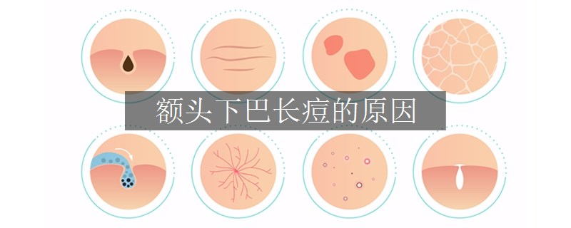 額頭下巴長(zhǎng)痘的原因